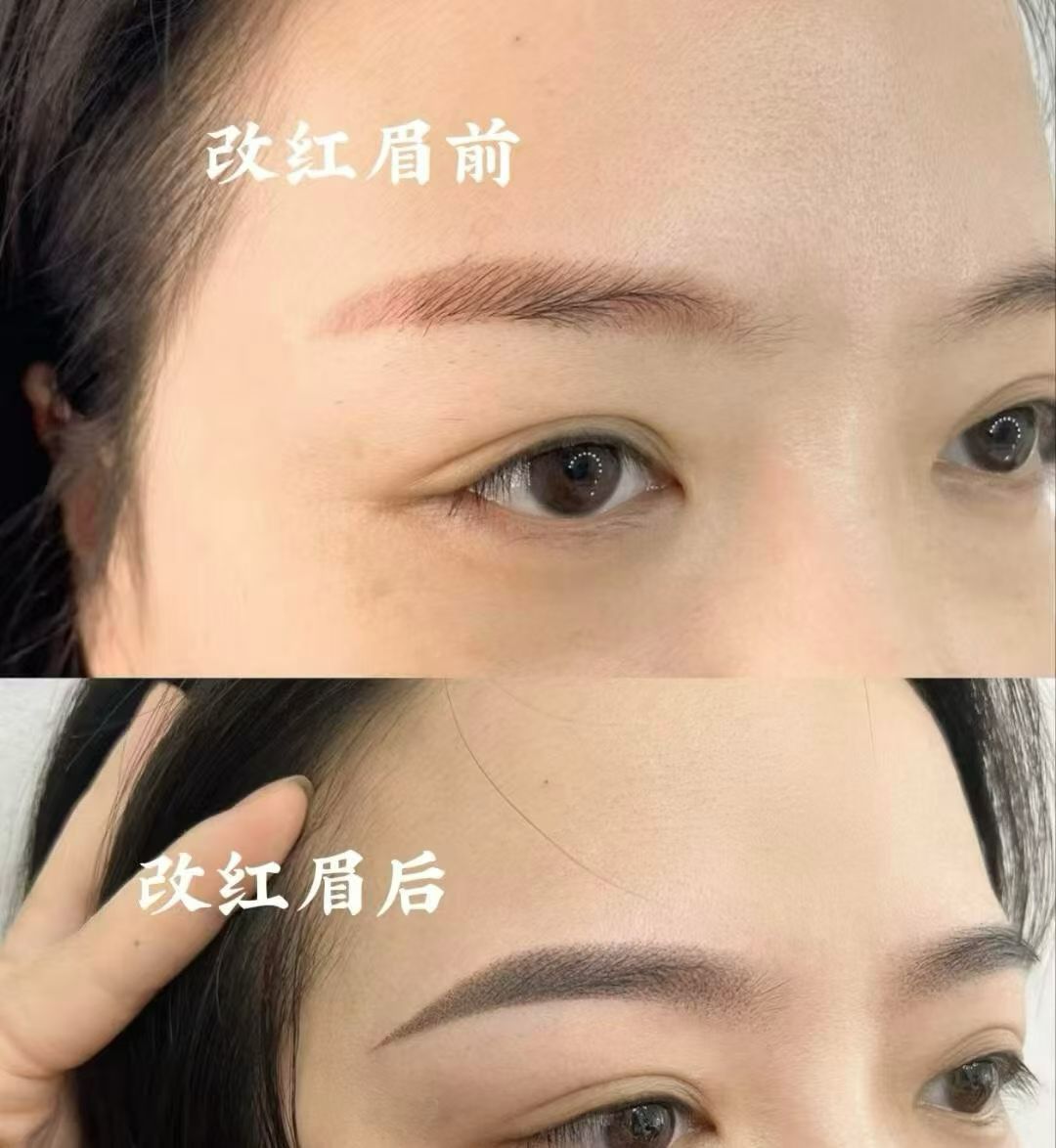 昭阳区轻奢妈生唇机构选择经验参考插图1