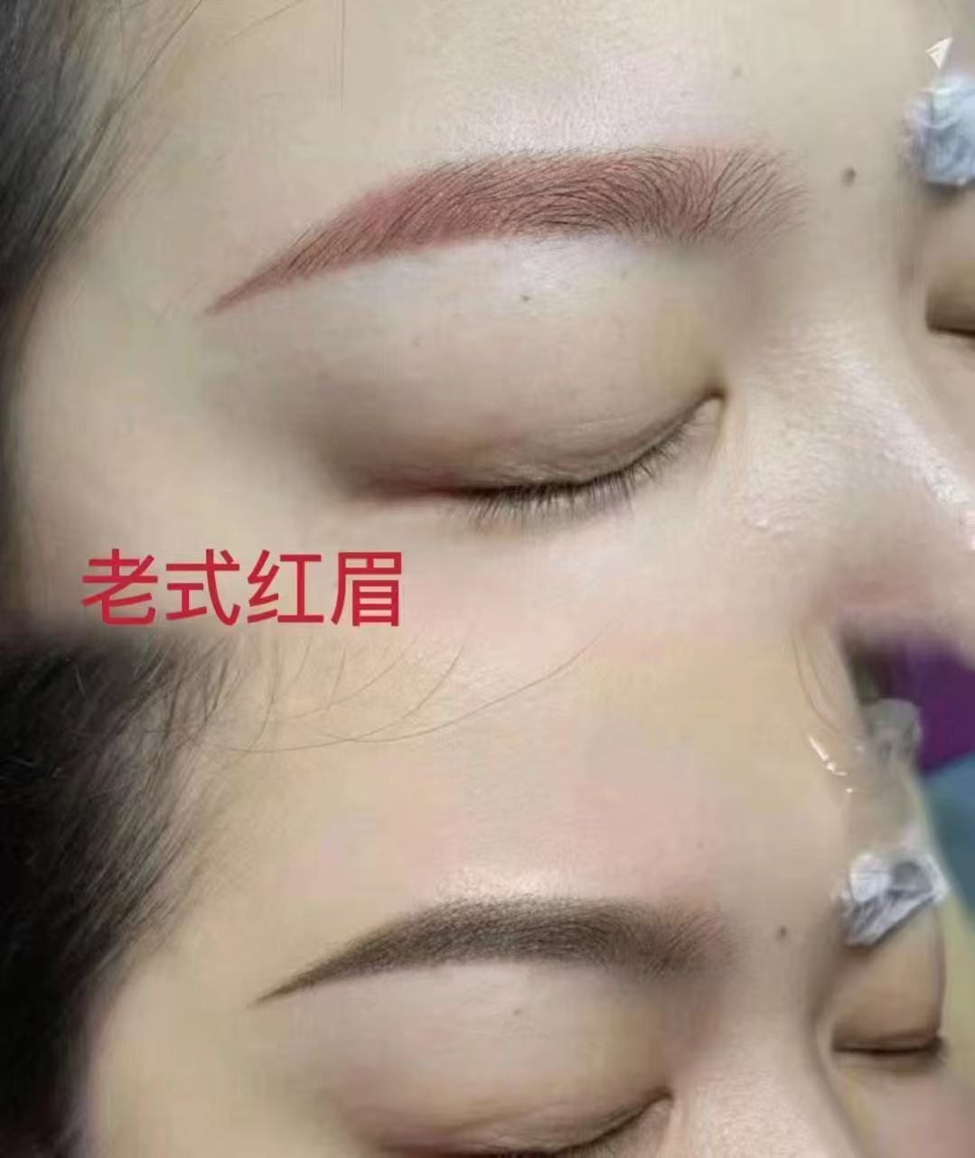 昭阳区轻奢妈生唇选择参考及应用经验分享插图2